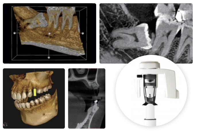 歯科用CT