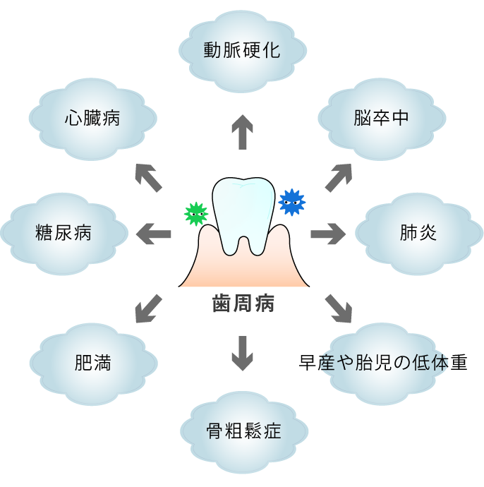 歯周病を放置していると、身体全体に影響が出ます