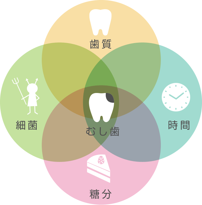 むし歯が発生する原因と予防